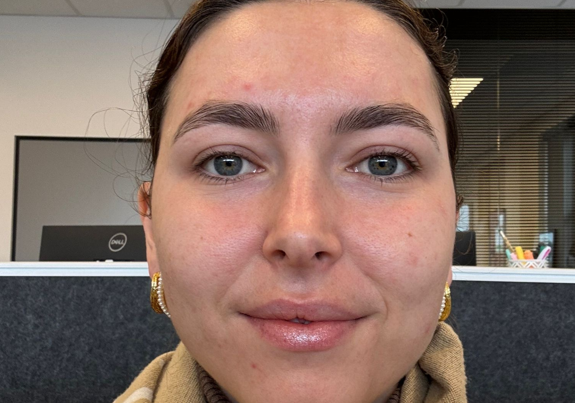 Close-up of a person with a neutral expression indoors. After radiance tallow.