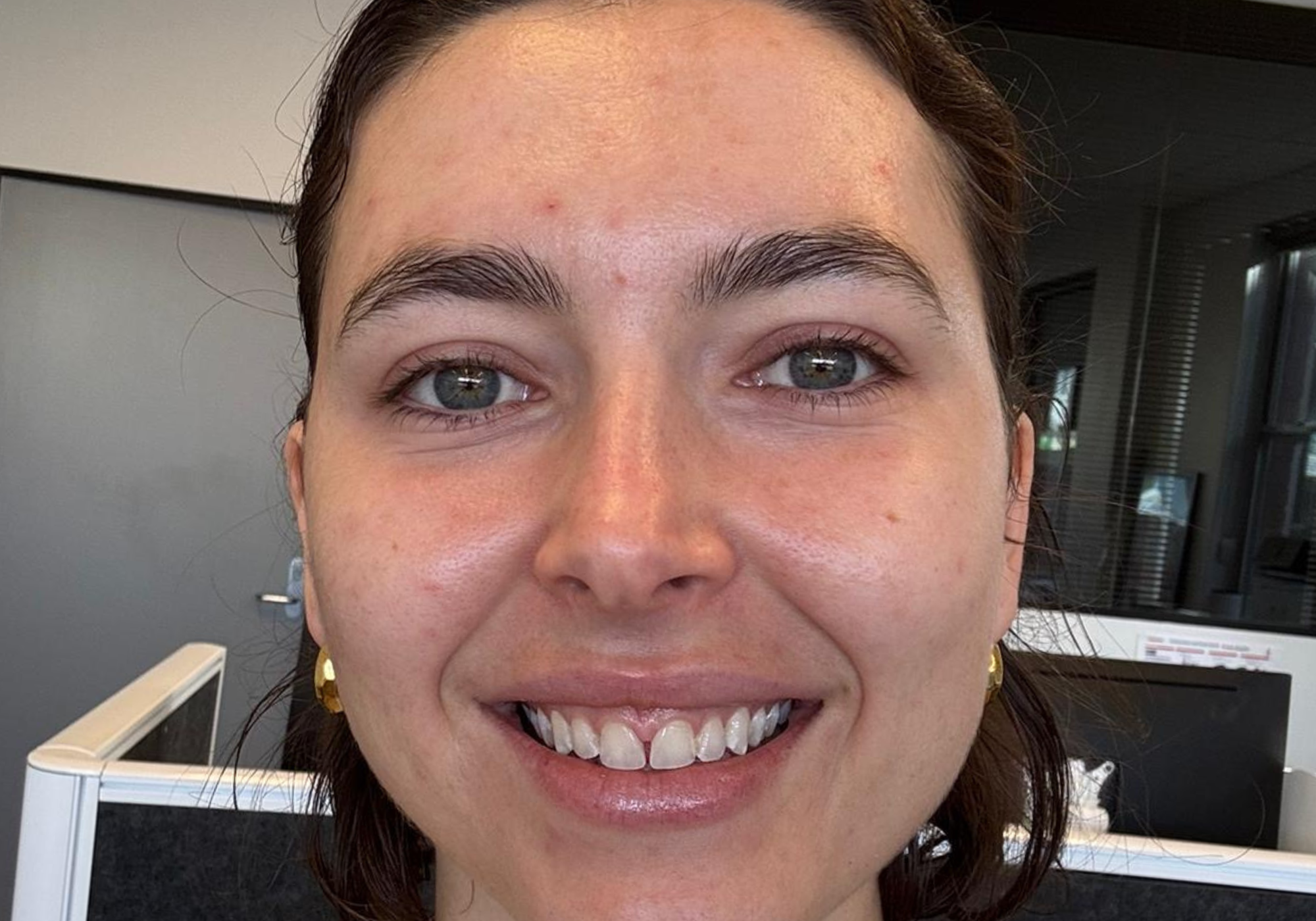 Close-up of a person with a neutral expression indoors. Before radiance tallow.